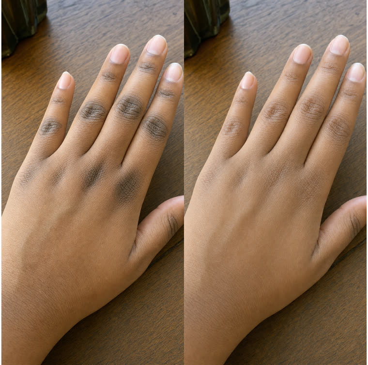 Before and after: Knuckles